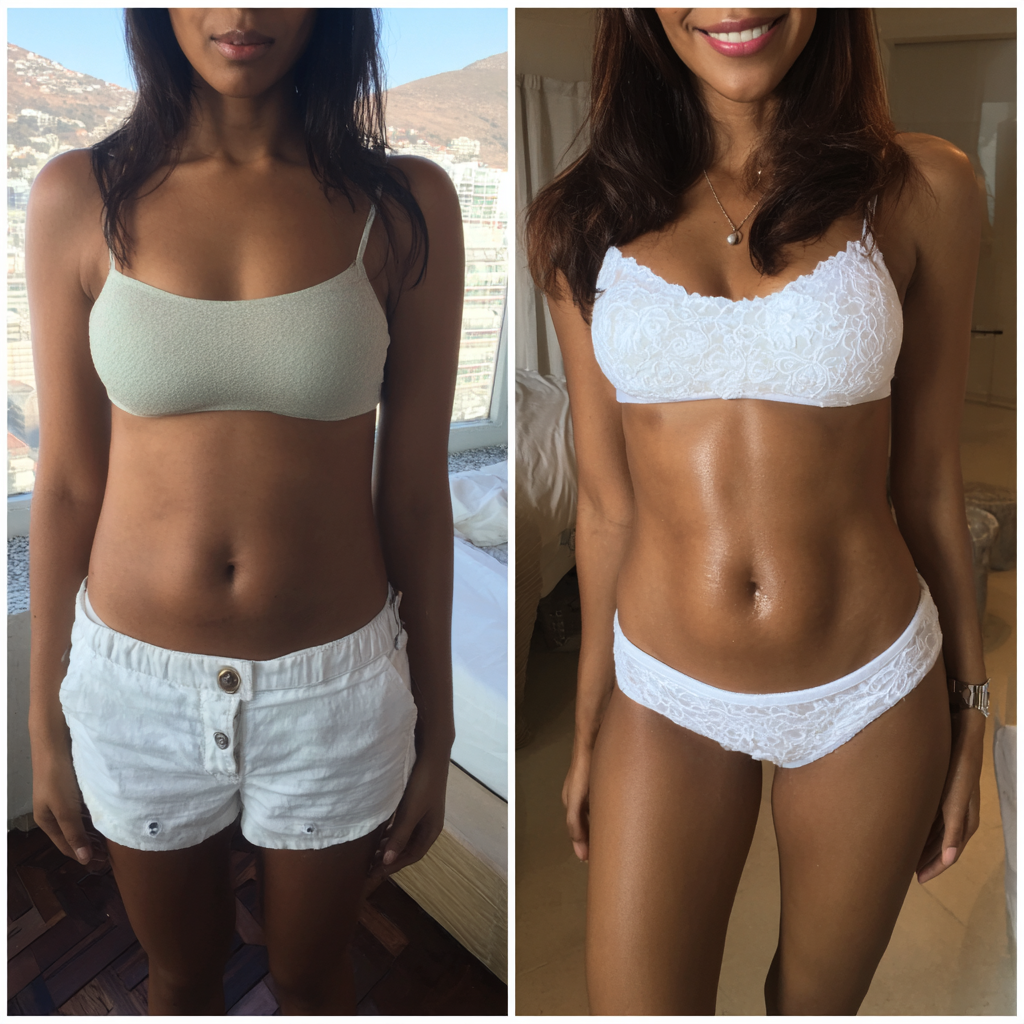 5 Tips for Maintaining Your Laser Lipo Results in Cape Town